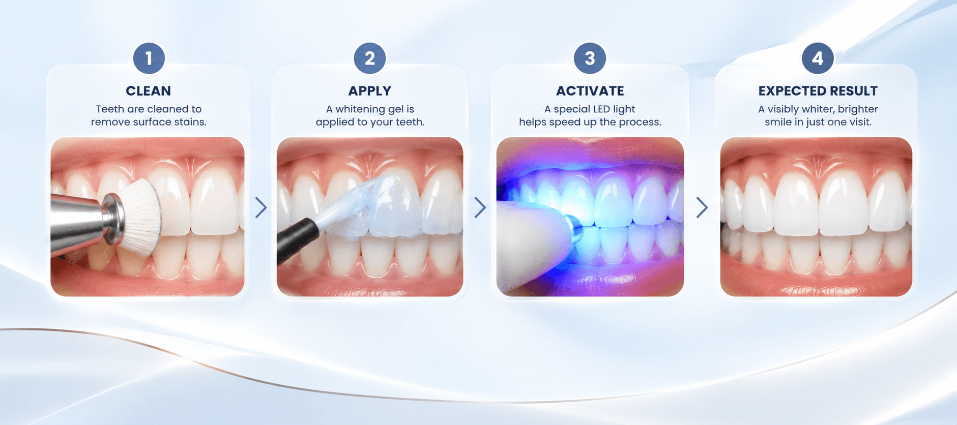 The four steps of in-clinic whitening: teeth cleaned, whitening gel applied, gel activated with an LED light, and the result checked